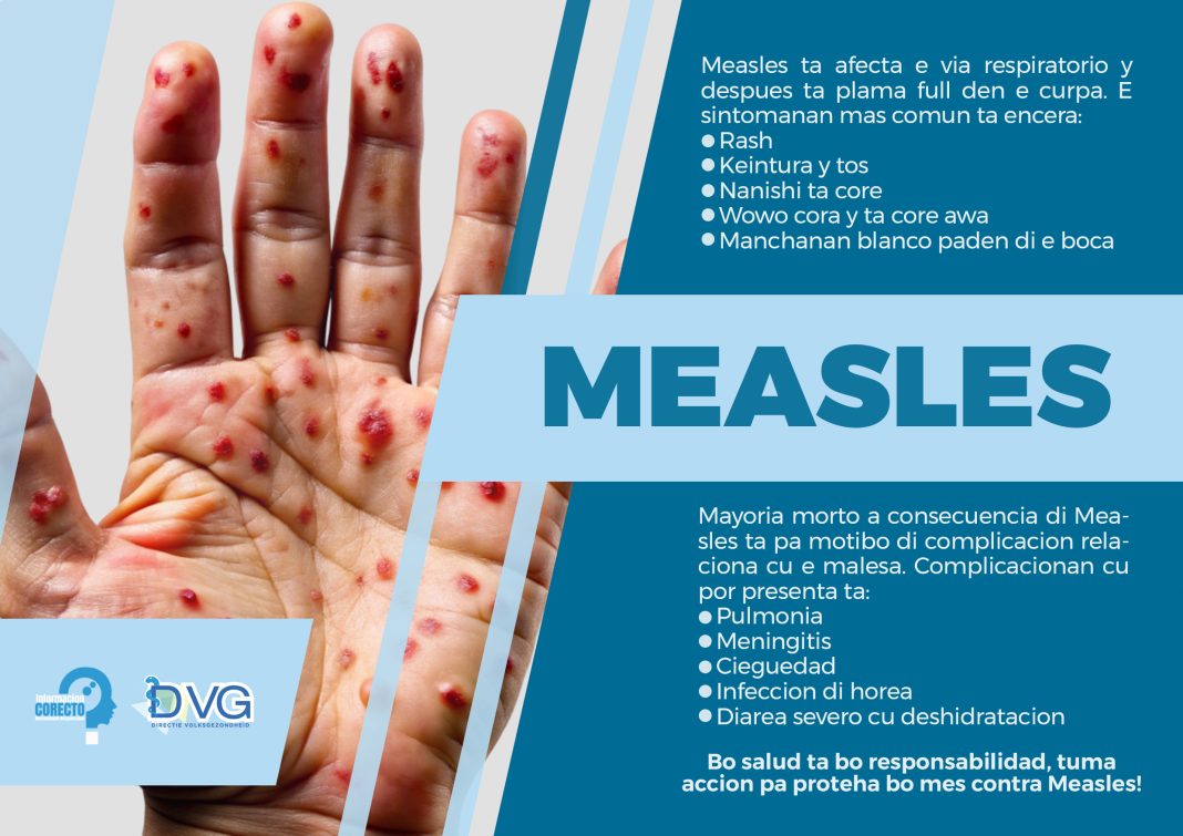 DVG wijst op signalen, symptomen en risico’s van mazelen DVG wijst op signalen, symptomen en risico’s van mazelen