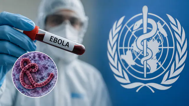 Sint Maarten kondigt gezondheidswaarschuwing en reisbeperkingen af vanwege ebola (Picture by: 721news.com)