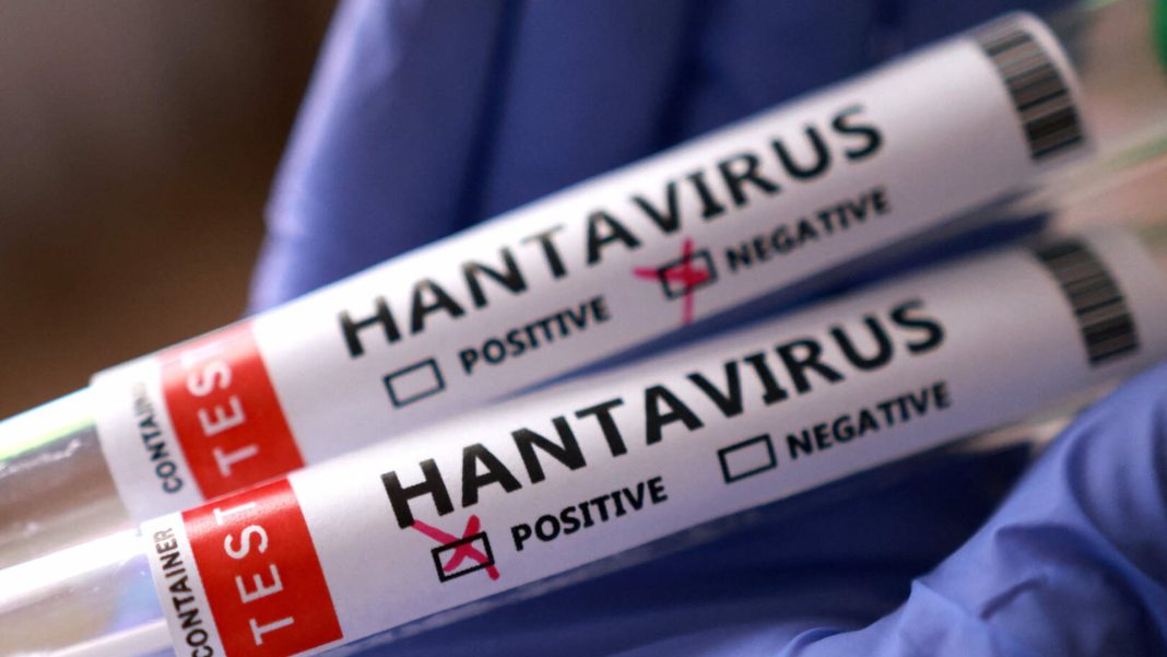 DVG: Hantavirus uit Venezuela vormt geen direct risico voor Aruba (Picture by: pubble.cloud)