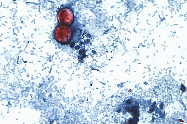 Twee doden door cyclospora uitbraak in Michigan (Picture by: aljazeera.com)